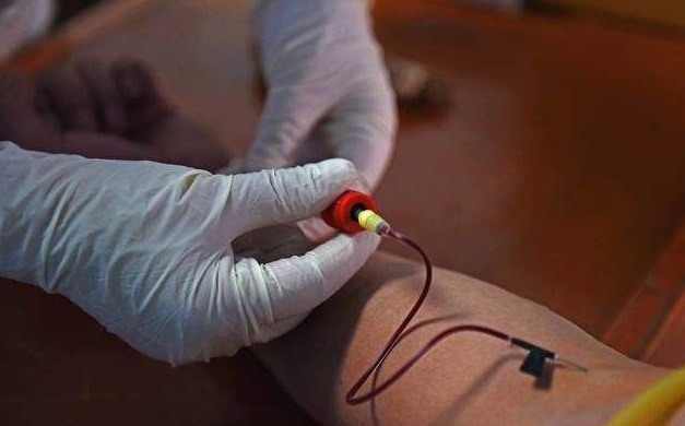 艾滋病病毒离体后能存活多久,离体的艾滋病病毒多久失去传染性