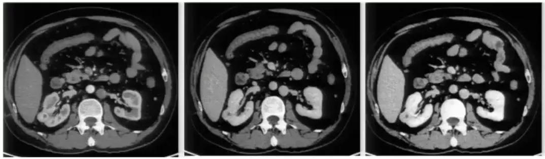 腹部ct详细讲解,腹部ct示意图及超详细教学