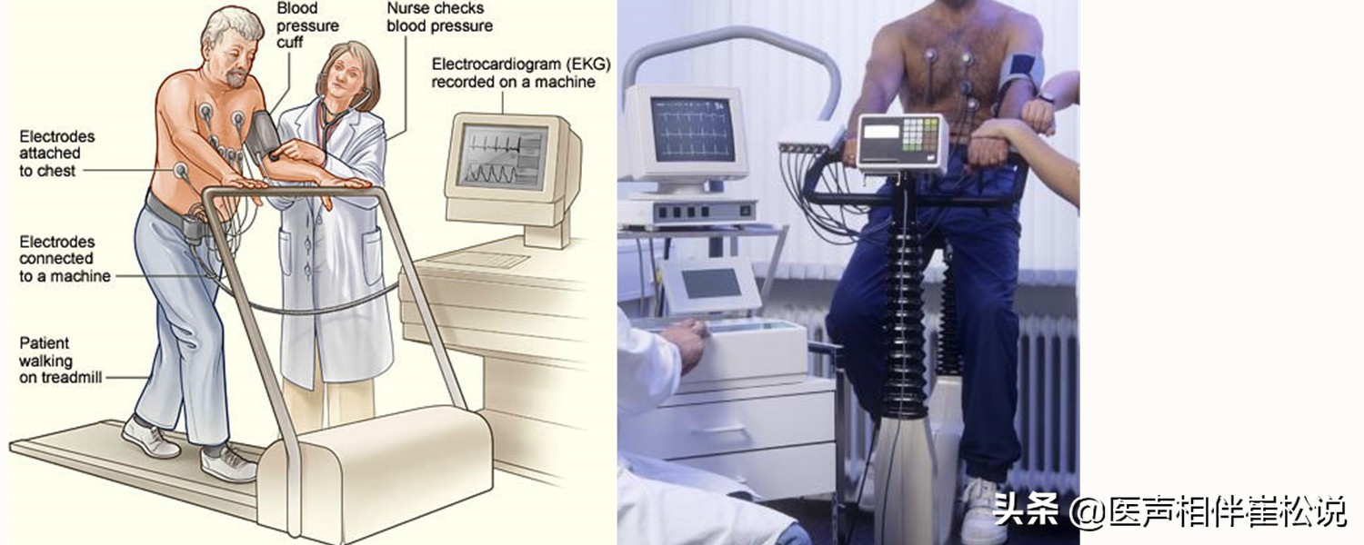 心电图t波改变心肌缺血,stt改变t波倒置是重度心肌缺血吗