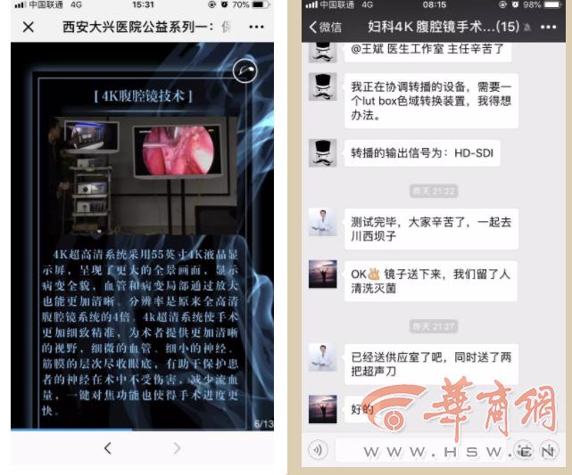 大兴医院宫腹腔镜,妇产科首例腹腔镜下胆囊切除手术