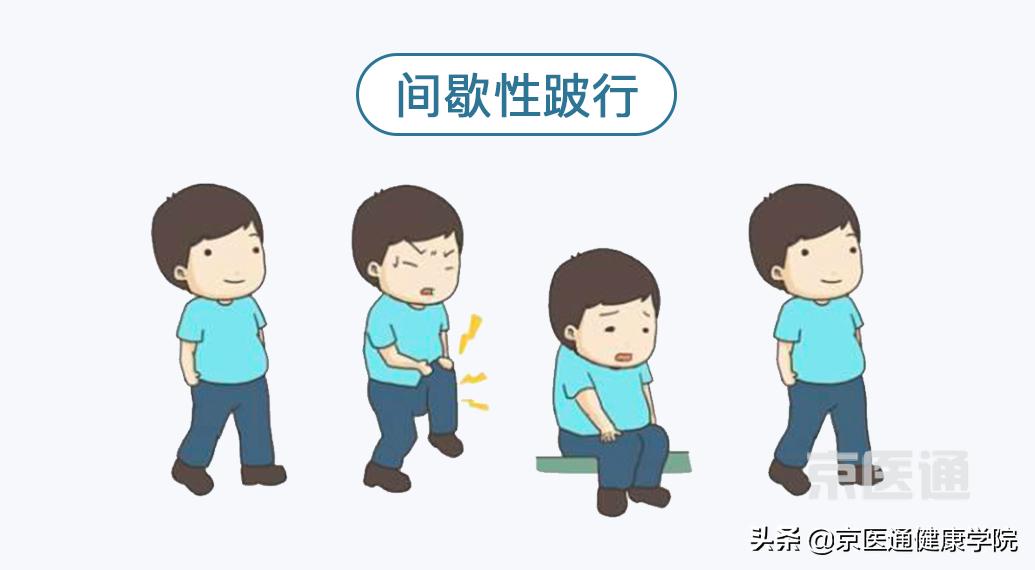 腰痛、腿痛是什么病？骨科医生用一块「羊蝎子」告诉你