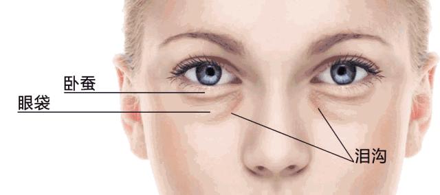 眼睛黑眼圈显老怎么办,眼睛黑眼圈大眼袋怎么消除