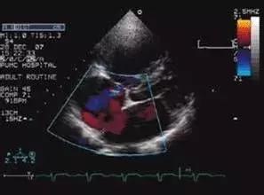 超声波b超可以检查什么病,超声波b超检查能查出什么