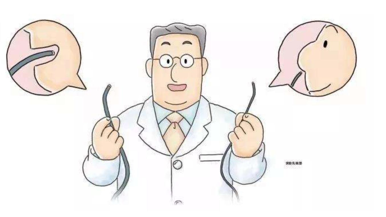 胃镜检查到底有多痛苦-消化内镜科普系列之一