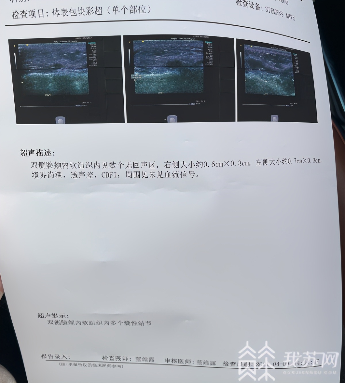 童颜针价格一般多少钱,童颜针揭秘