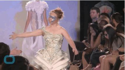 唐氏综合征中国美女,患有唐氏综合征的维密模特