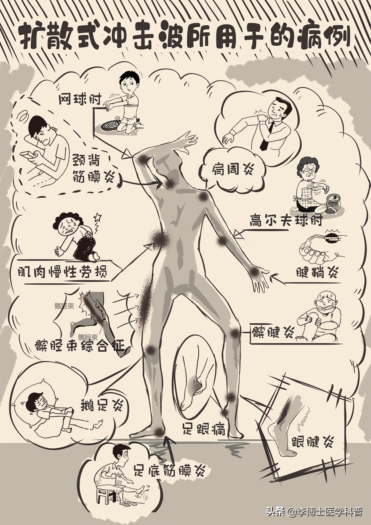 走路咔咔响的膝关节一招教你搞定,膝关节抽积液后咔咔响怎么回事