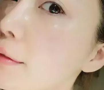 护肤太多的坏处有哪些呢,护肤越补越糟糕