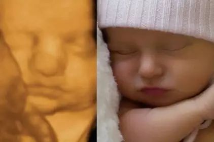 四维彩超显示胎儿一斤胎儿算胖吗,四维彩超胎儿怎么都长一个样