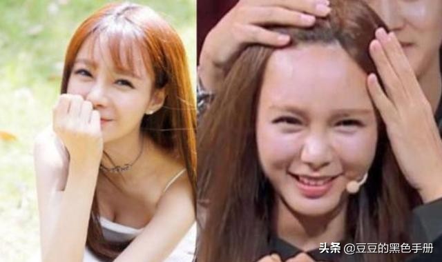 脑门大发际线高的女明星,大脸大脑门秃头女生适合的发型