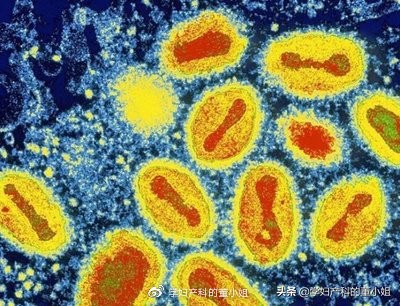 阴道炎反复复发？看这一篇就够了