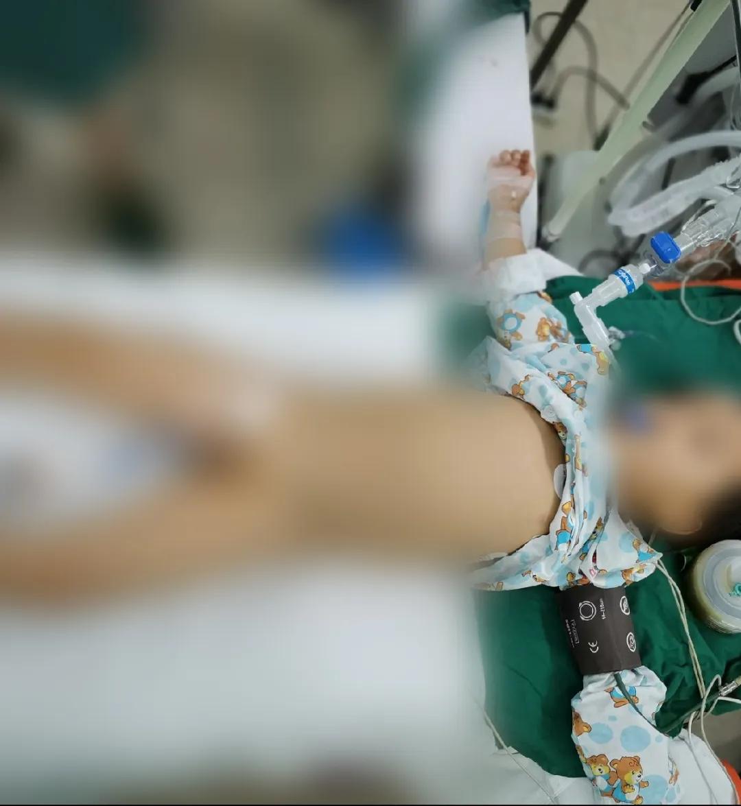 家长要注意宝宝这三个动作,儿童小肠切除了大部分还会长吗