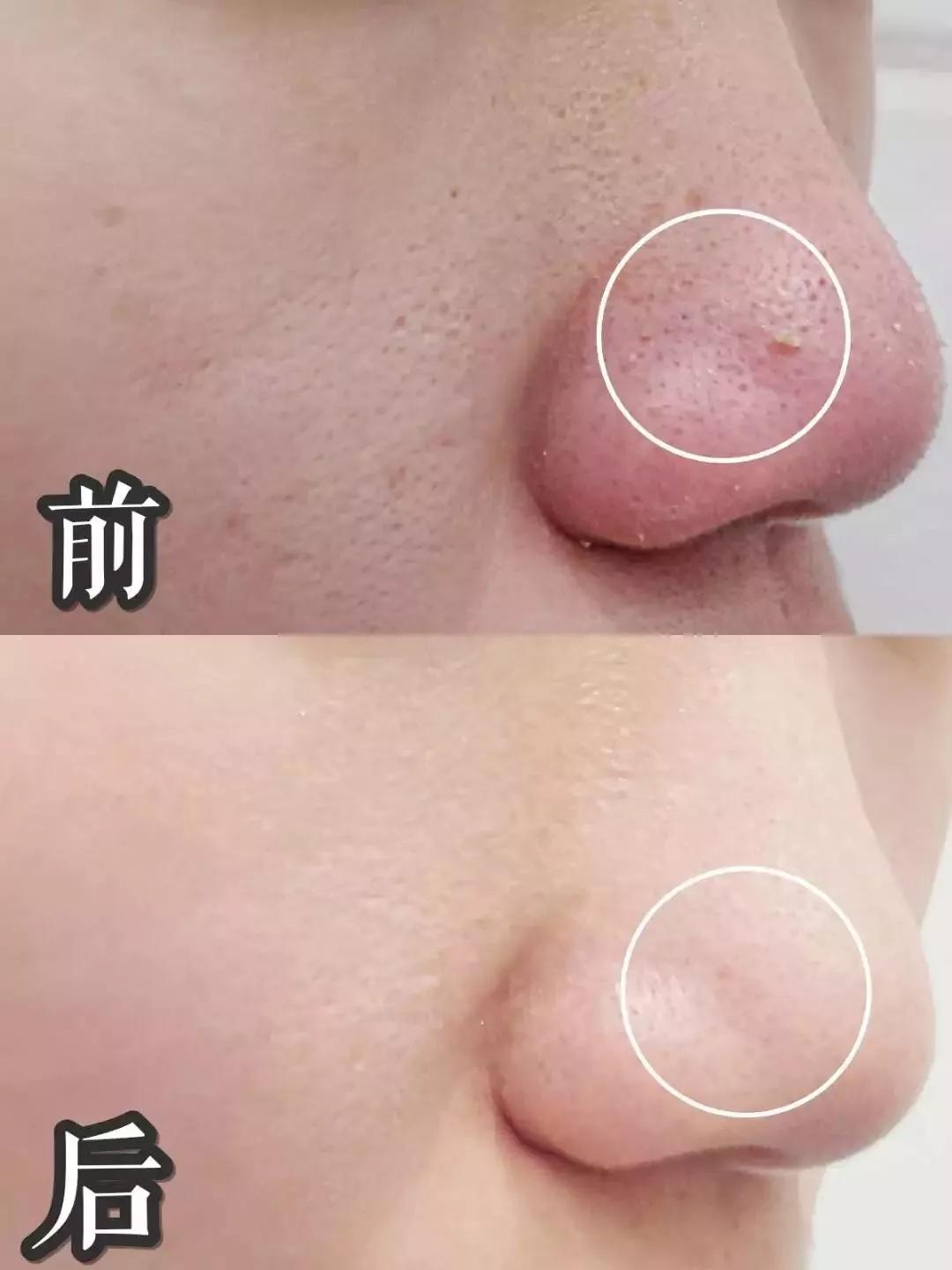 快用完的洗面奶,真正有效的清洁毛孔的洗面奶