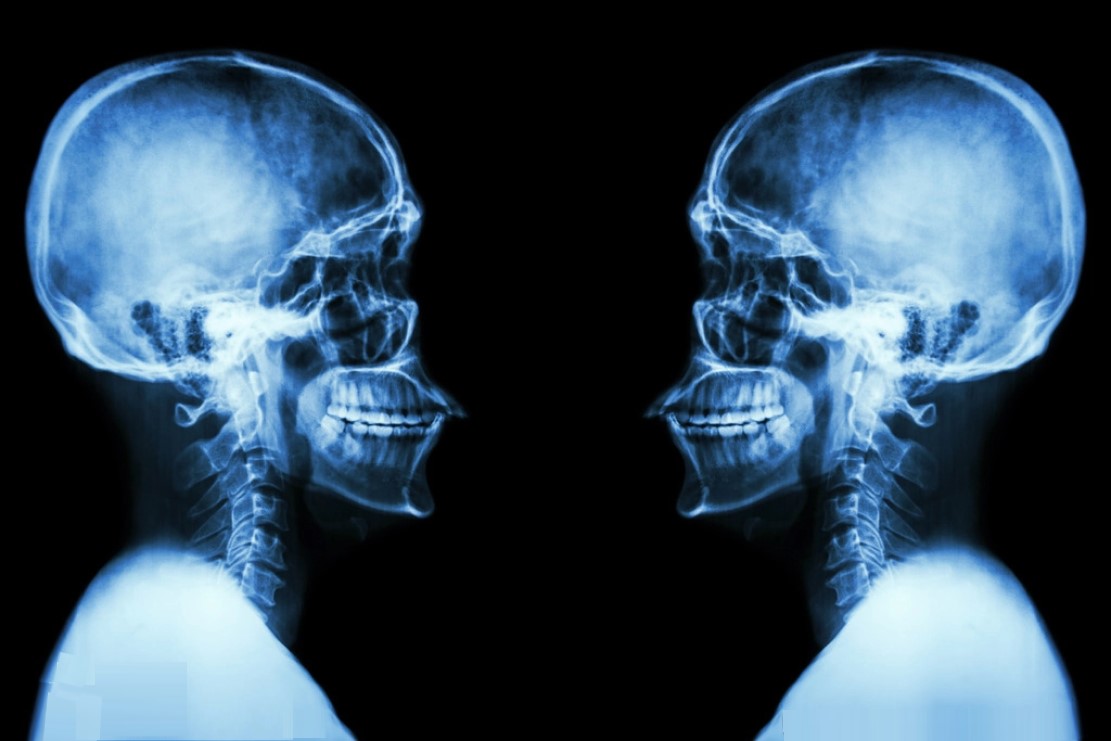 什么是X射线，它是如何被发现的，对人类有多大影响？