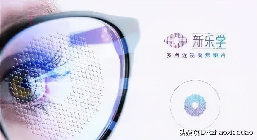 近视防控全书,近视防控知识全套