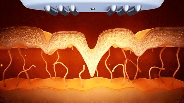 女明星疯狂买买买，御龄黑科技如何加持