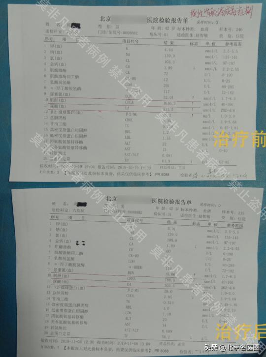 尿毒症肌酐900吃中药可以降下来吗,尿毒症肌酐降到196还用长期透析吗