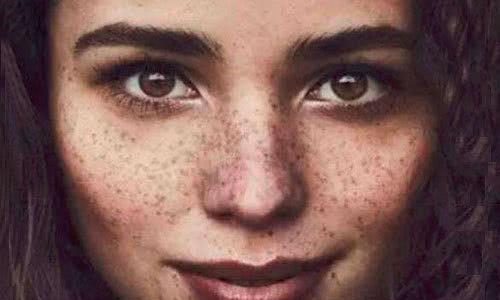 长斑的原因是先天还是后天,容易长斑的十件事