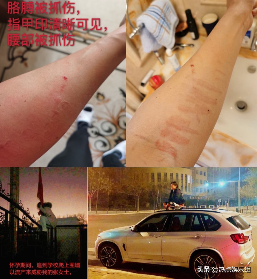 张培萌被反转,张培萌被曝家暴官方解释