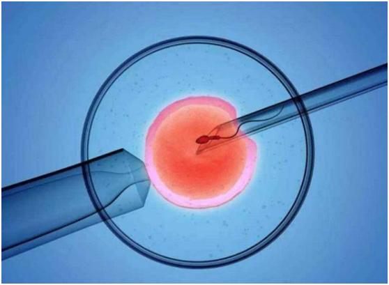 中国支持试管婴儿,助力让每个孩子圆梦