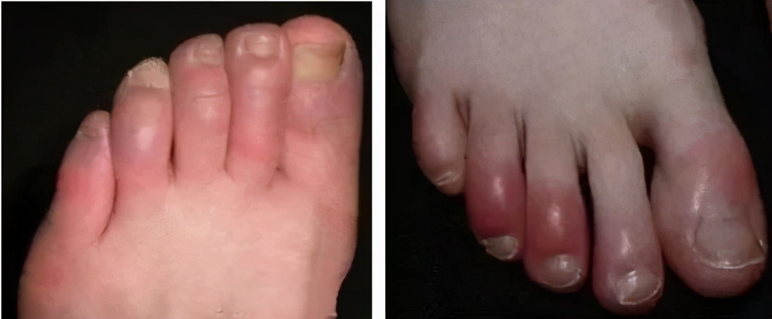 卖爆了的保暖袜子,卖爆20万双的雪地袜