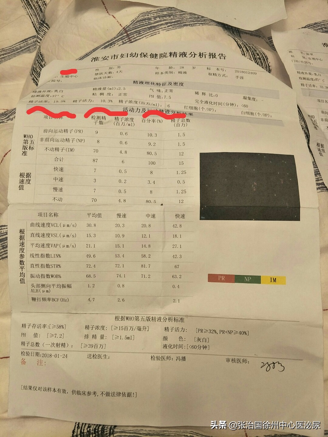 一次检测精子活力低会不会有误差,一次精子检测能说明问题吗