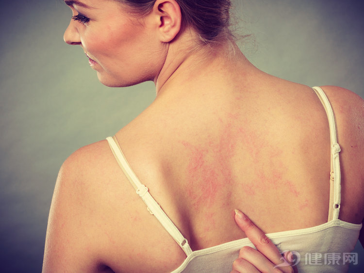 肛门处有点痒自己可以怎样处理,肛门瘙痒四个办法可以解决