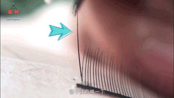 睫毛长扎眼睛该如何处理,睫毛长扎眼睛怎么办小妙招