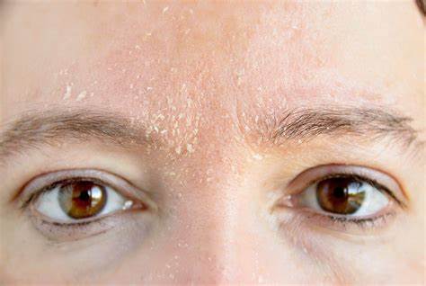 面部瘙痒发红干燥刺痛,皮肤瘙痒身上三处发痒要当心了