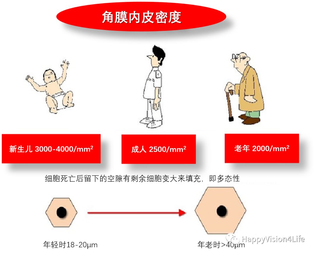 洞察超乳术后角膜的水肿
