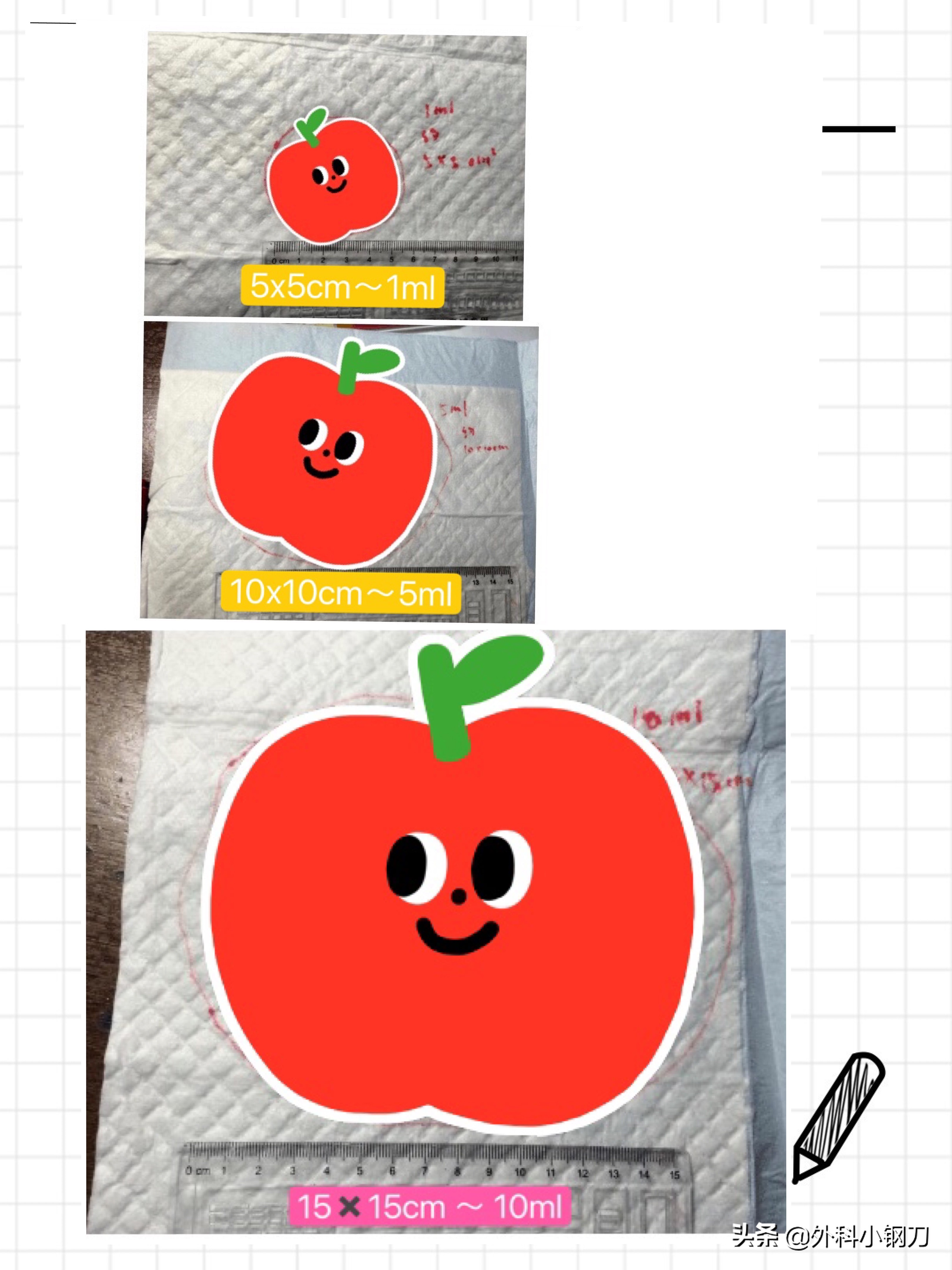 心好方，便便里面全是血，不想去医院，是不是癌啊，我该咋办？