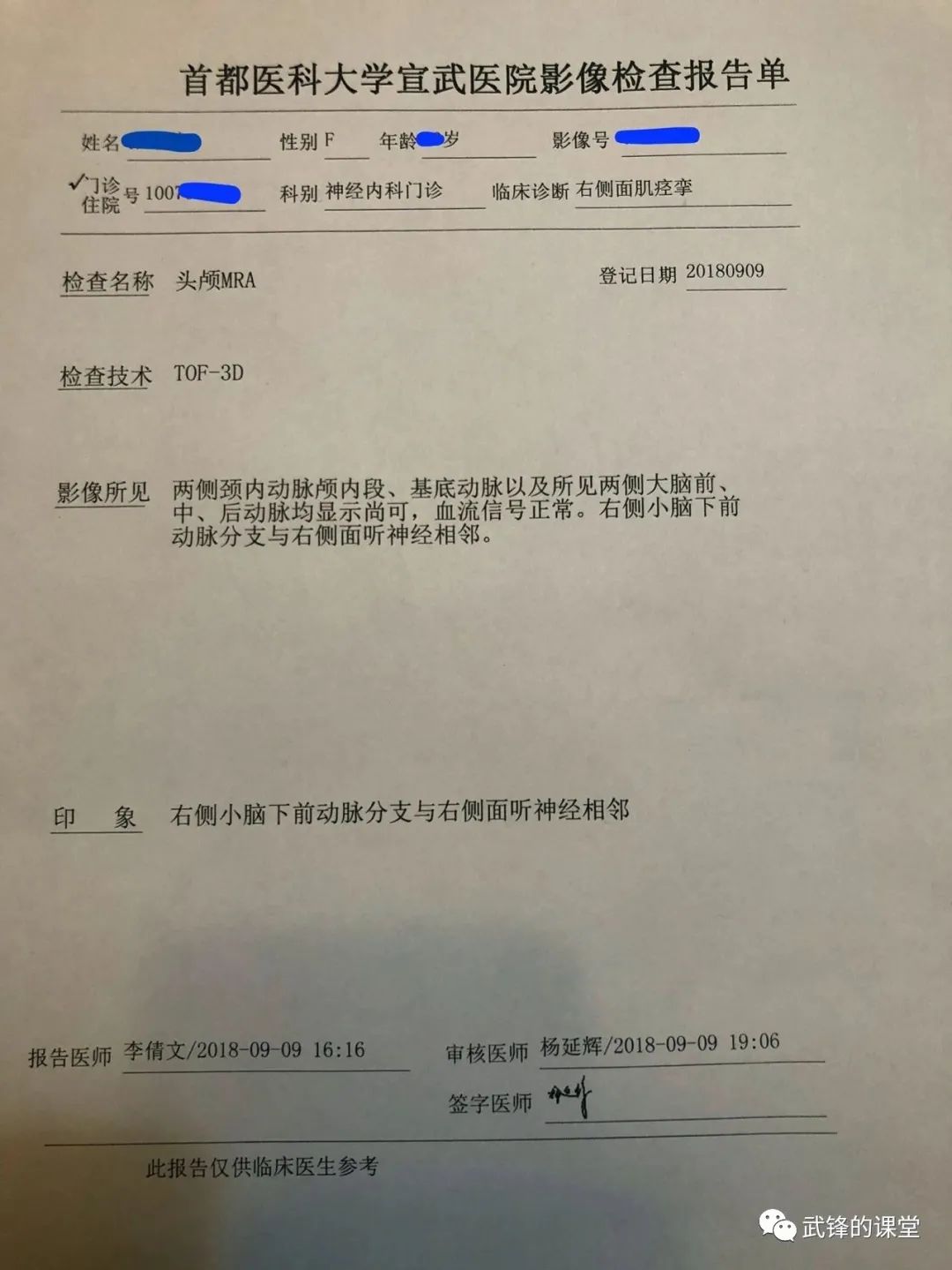 中医治疗面肌痉挛的针灸视频,面肌痉挛药物治疗案例分享