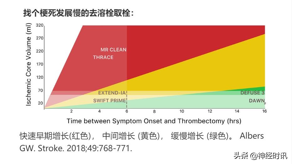 急性脑梗死取栓术的护理,脑梗死溶栓取栓围手术期护理常规