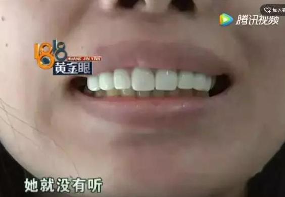 看牙花50万,看牙花了2000块钱
