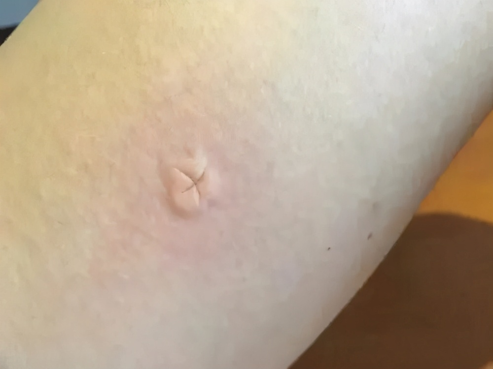 驱蚊必备蚊香防蚊神器,防蚊必备电热蚊香驱蚊神器