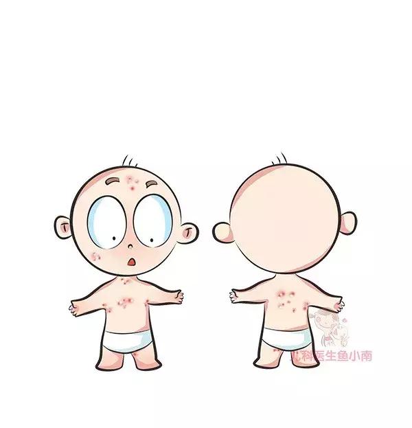 小朋友起皮疹热疹抹什么药,孩子过敏皮疹和热疹有啥区别