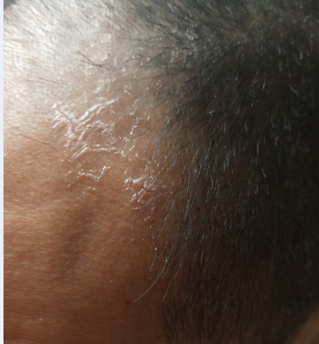 鱼刺卡喉祖传秘方求救,鱼刺卡喉轻松解决快1年了