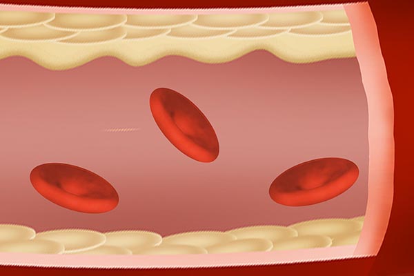 人到中年身上长小红痣是什么原因,身上手上长小红痣不痛不痒