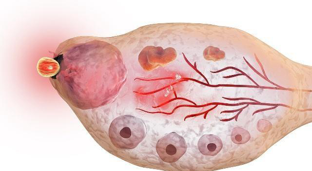 女性在排卵有什么感觉,女生排卵的时候都有哪些表现