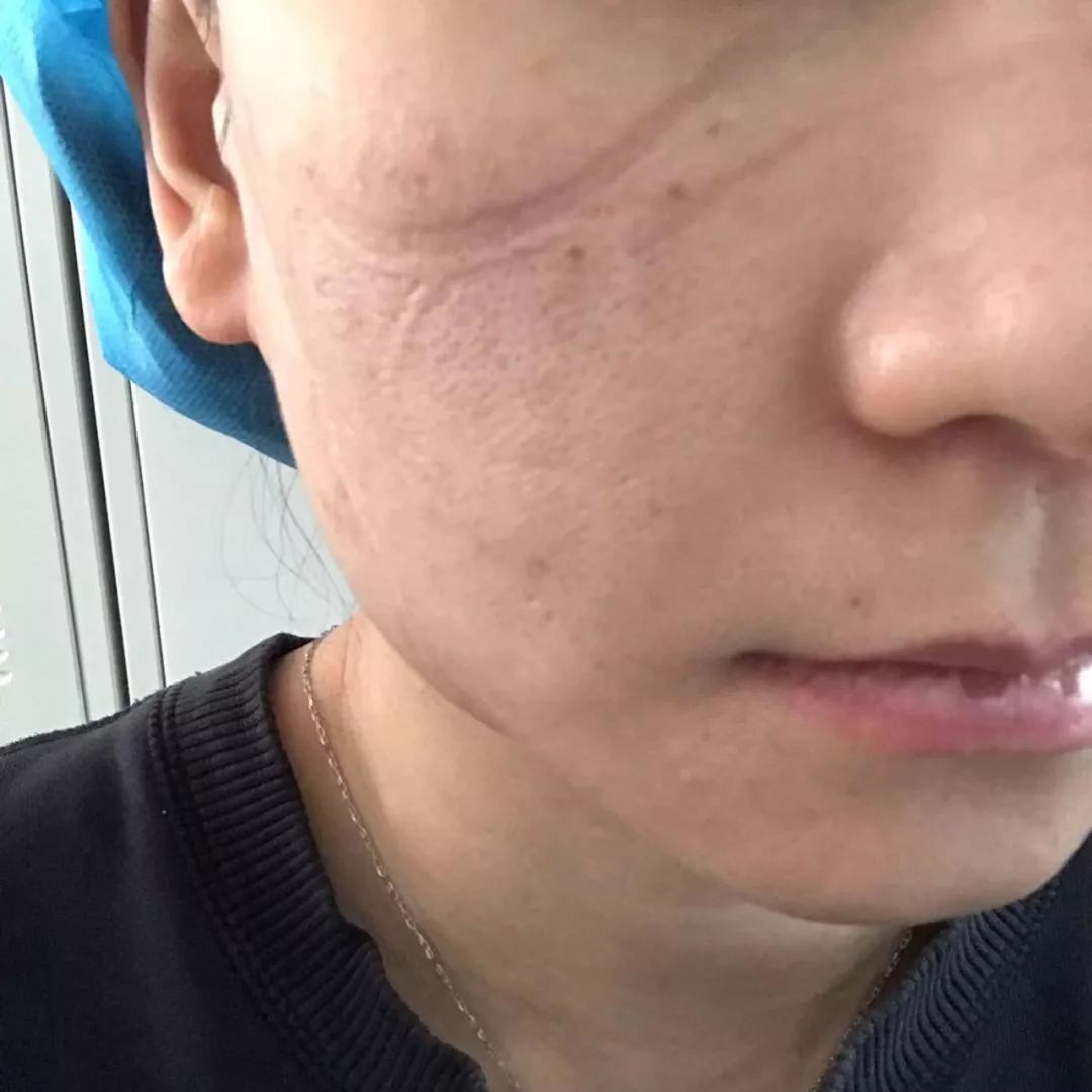 封城11日，武汉众生图