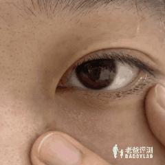 一用眼霜眼袋就严重,第一次用眼霜居然长了脂肪粒