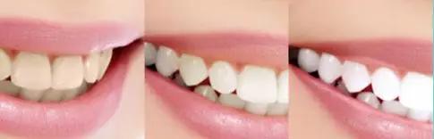 戴眼镜的女生美吗,戴眼镜女生为啥受欢迎