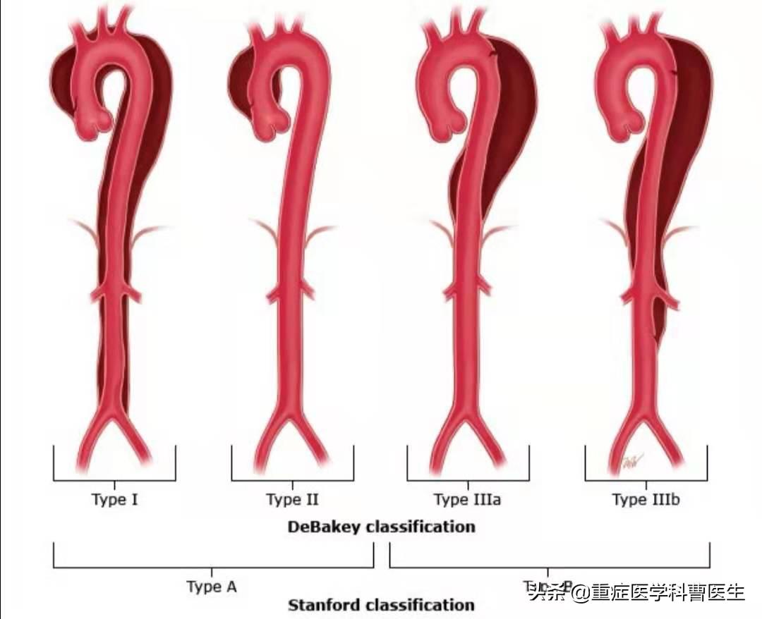 降压药不能擅自停服,降压药吃了不能吃啥