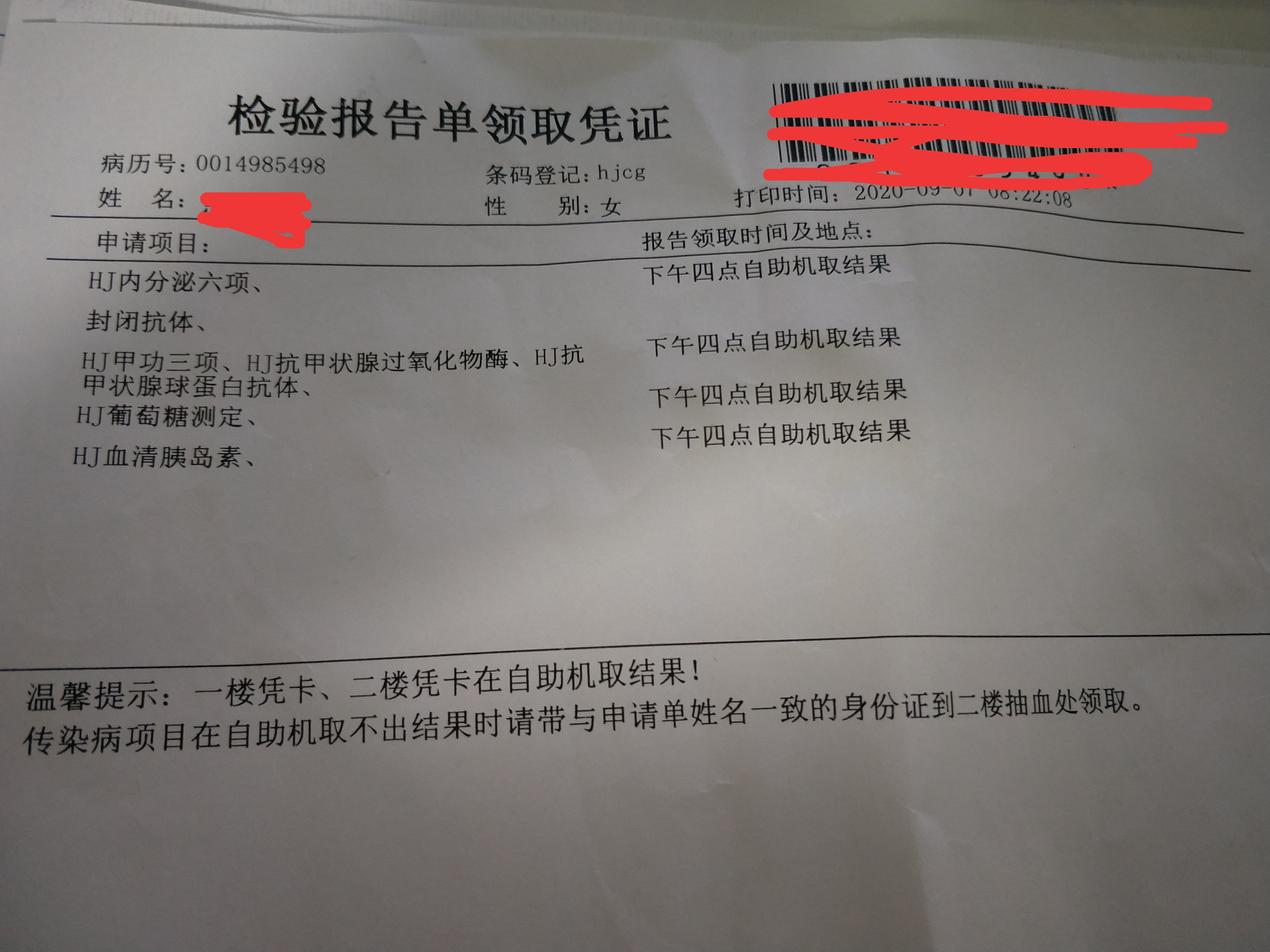多囊卵巢胰岛素低会得糖尿病吗,我才28岁血糖高是什么原因呢