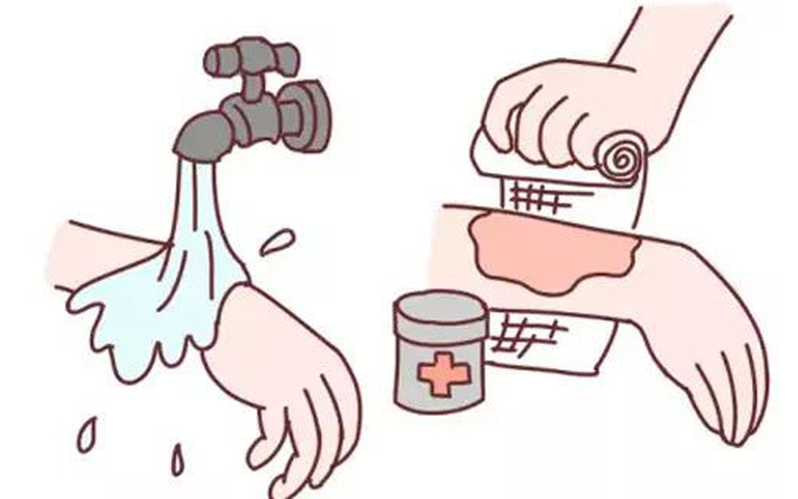 疫情期间儿童发烧怎么自救,儿童烧烫伤的早期防护及急救措施