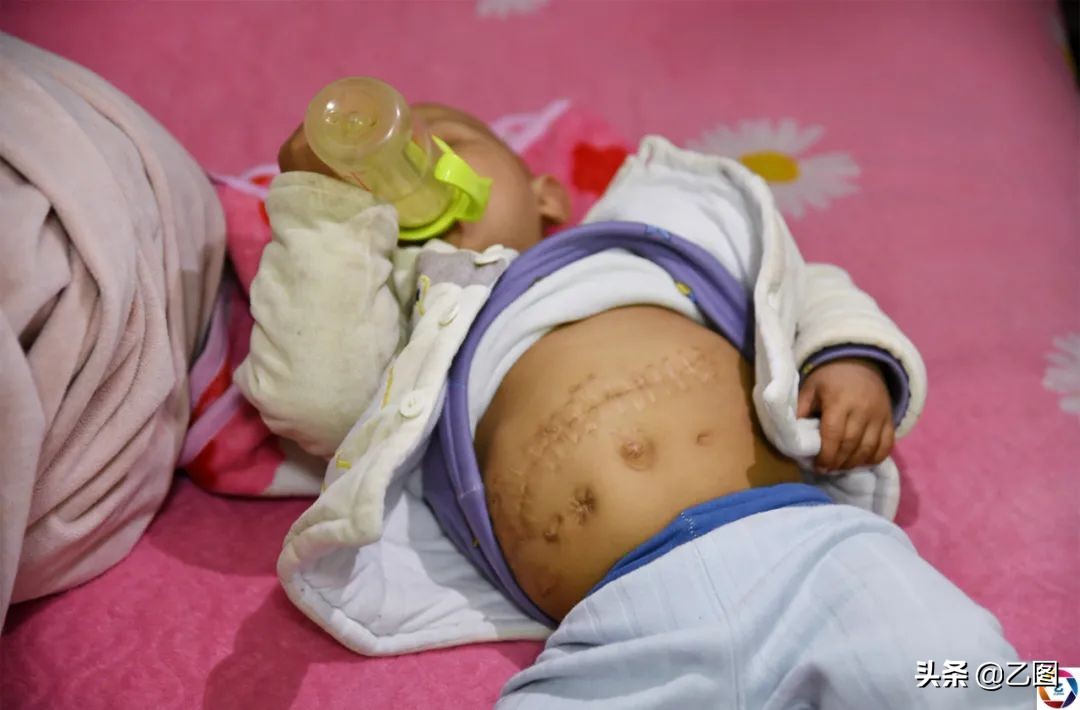 世上最悲催的婴儿,人间悲惨的孩子