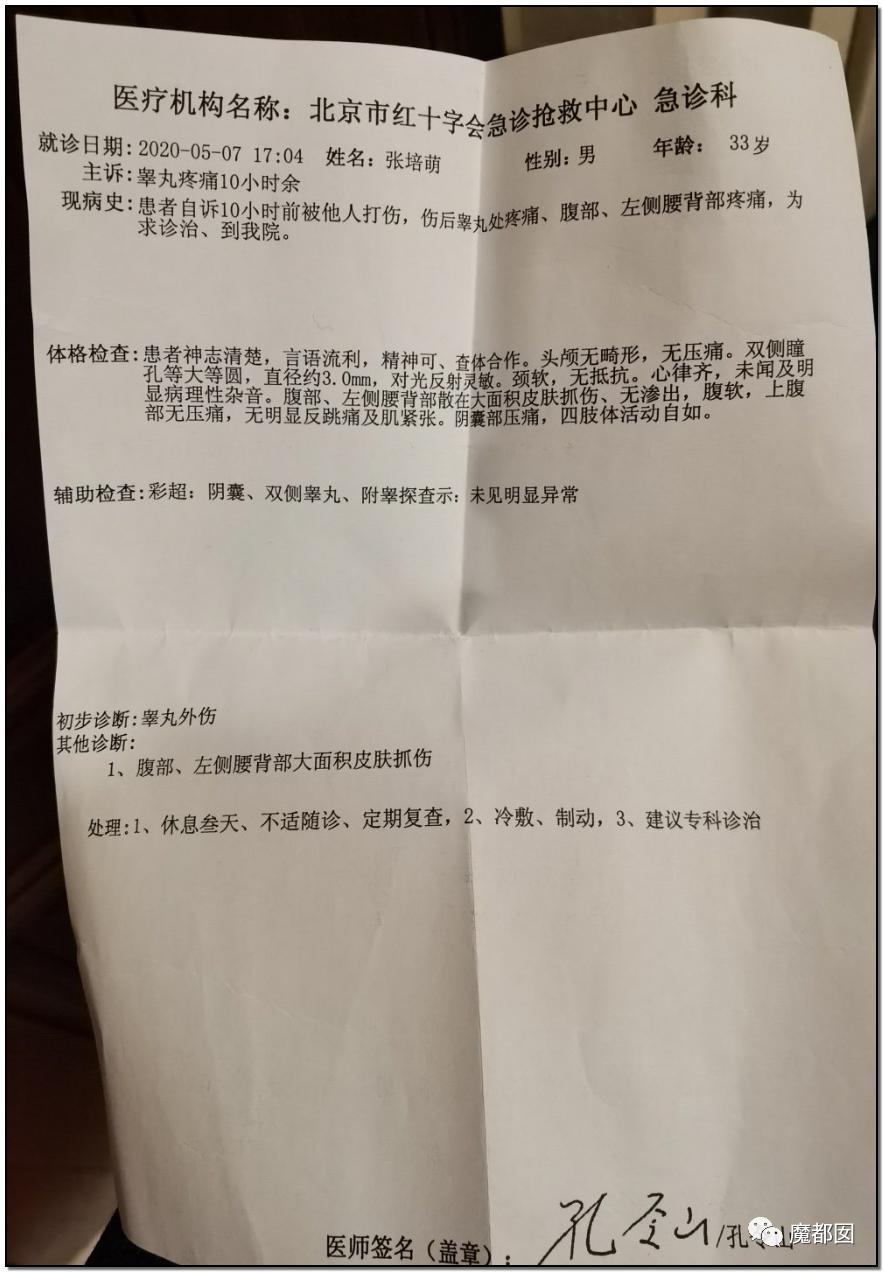 短跑名将张培萌家暴事件,短跑名将张培萌被控家暴
