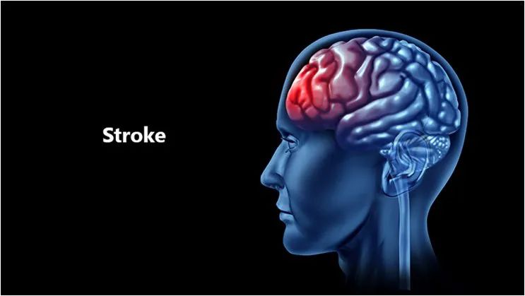 干细胞治疗脑中风效果好吗,干细胞治疗脑中风的最新技术