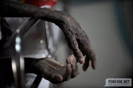 这里租妻合法，艾滋指数全球第一，每年竟还有3000万人要去