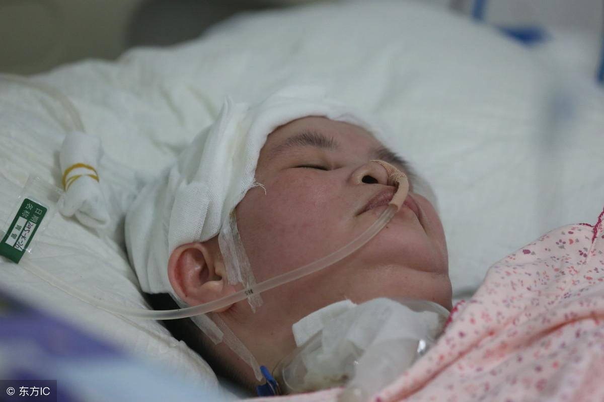 脑溢血能治好吗能不能恢复正常,脑溢血能完全治好吗